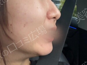 治療結果の症例写真