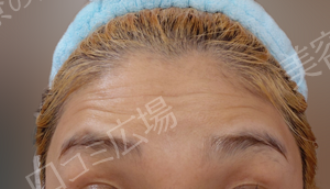 治療前の症例写真