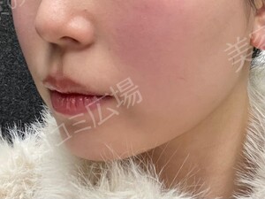 治療前の症例写真