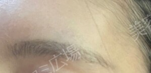 PRISM Beauty Clinicの症例写真[アフター]