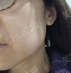 治療結果の症例写真