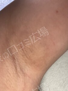 治療結果の症例写真