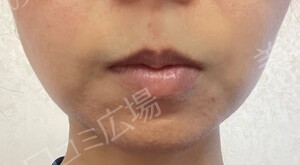 治療結果の症例写真