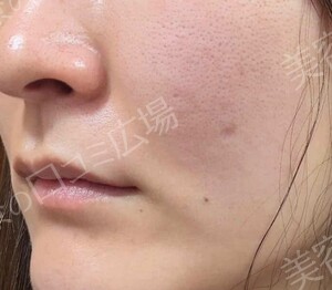 治療前の症例写真