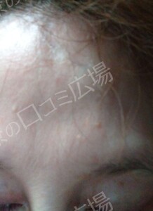 治療結果の症例写真