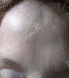 治療結果の症例写真