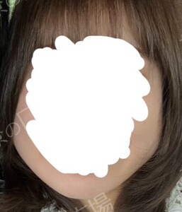 治療前の症例写真