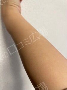 治療結果の症例写真