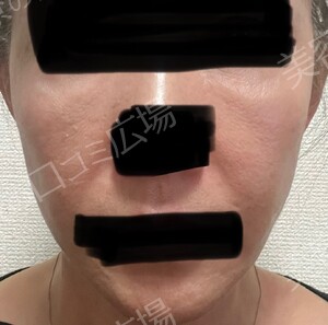 宮益坂クリニックの症例写真[アフター]