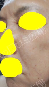 治療結果の症例写真