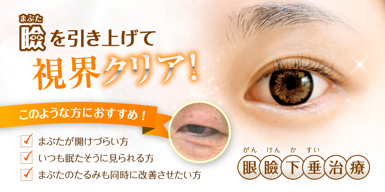 ドーズ美容外科 佐賀院の眼瞼下垂 美容医療の口コミ広場