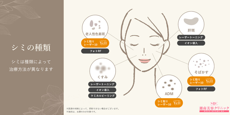 湘南美容クリニック 赤羽院のシミ取り 肝斑 毛穴治療の料金 費用 美容医療の口コミ広場